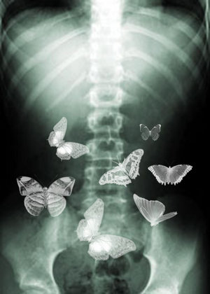 http://embuscadophino.files.wordpress.com/2009/08/butterflies_in_my_stomach_by_bee_ee.jpg